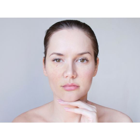 co na rozszerzone naczynka na twarzy? Kosmetyki tołpa.® dermo face rosacal