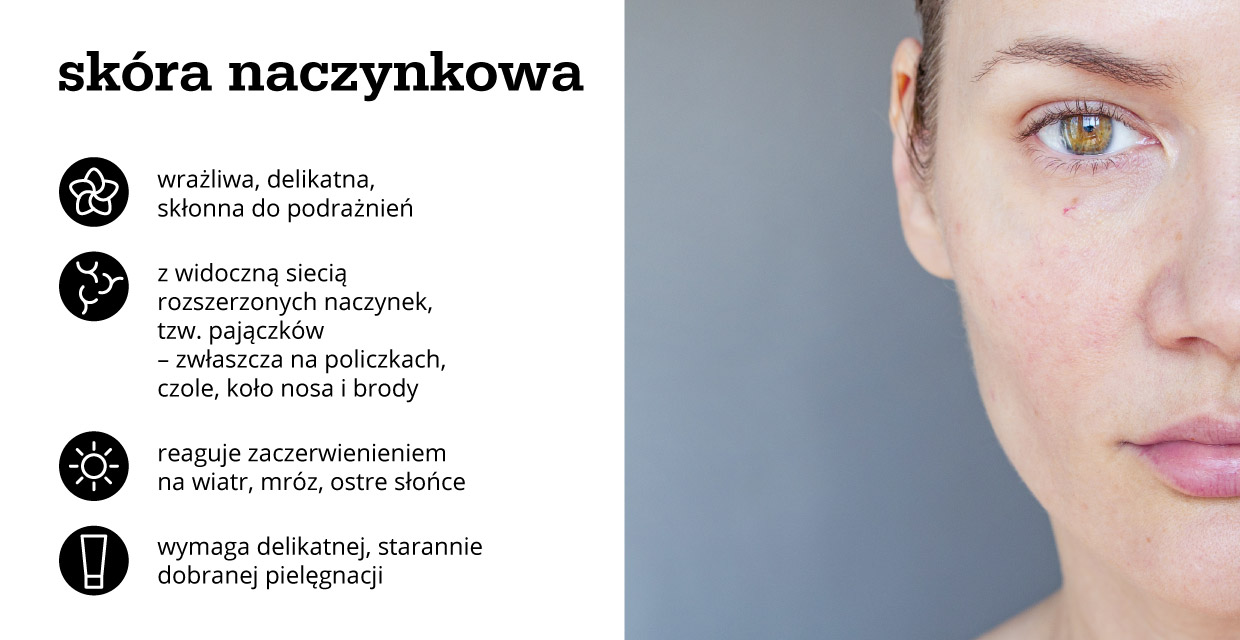 Cera naczynkowa - infografika