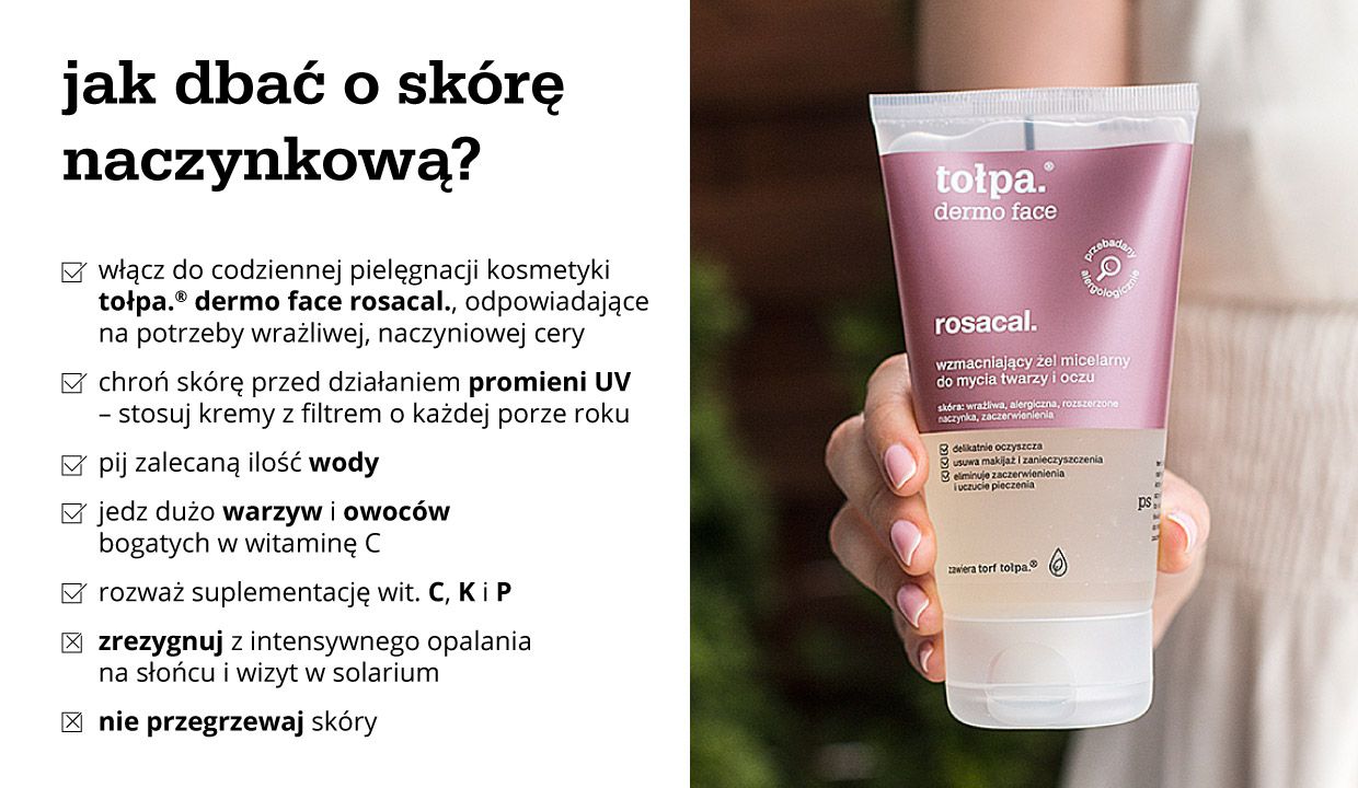 Jak dbać o cerę naczynkową? - infografika