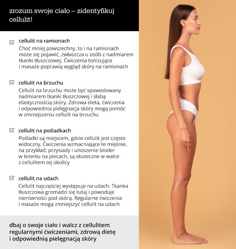 Zrozum swoje ciało – zidentyfikuj cellulit! - infografika