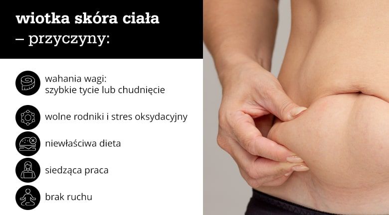 Wiotka skóra ciała – przyczyny - infografika