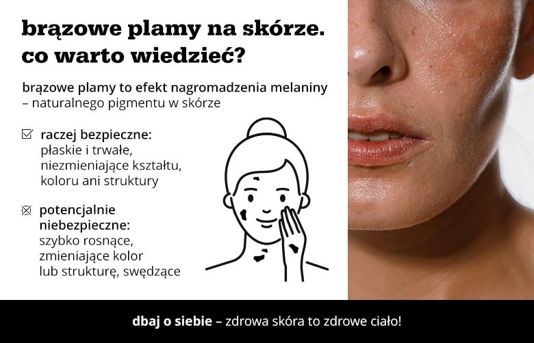 Co warto wiedzieć o brązowych plamach na skórze?