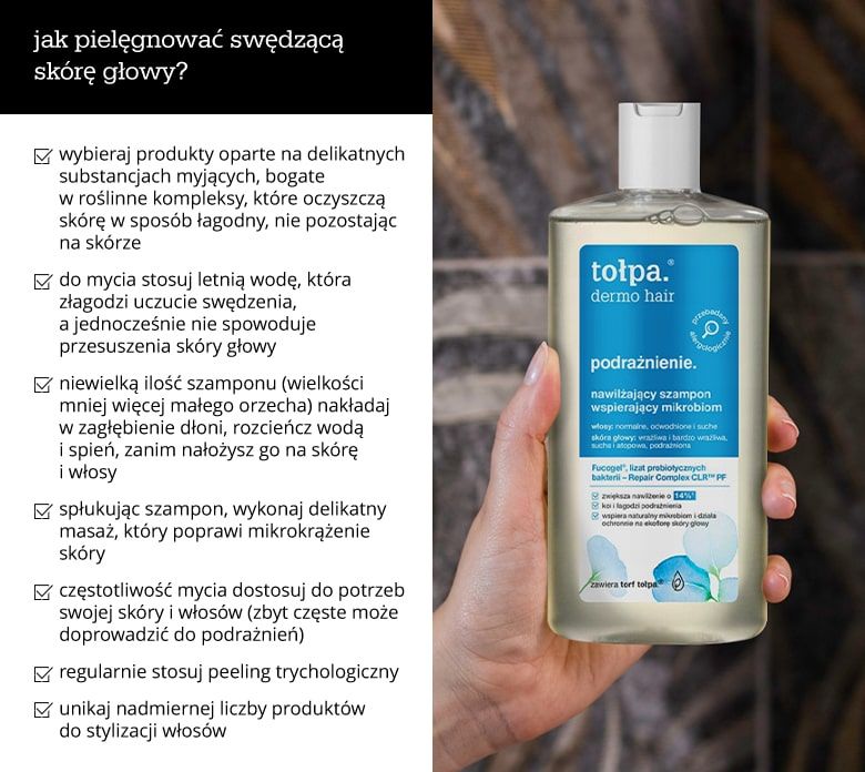Jak pielęgnować swędzącą skórę głowy - infografika