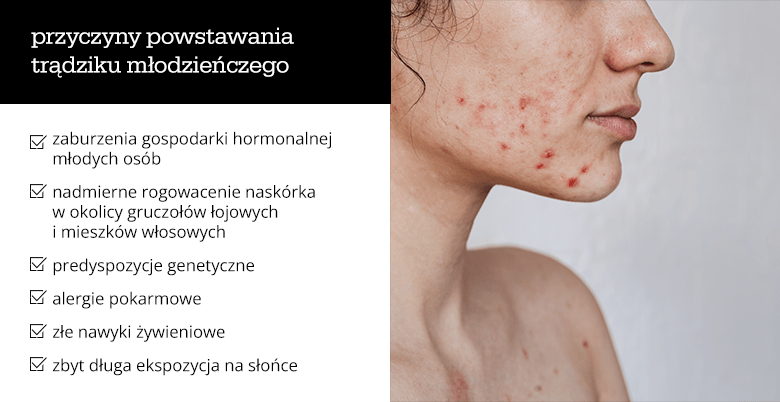 Przyczyny powstawania trądziku młodzieńczego - infografika.