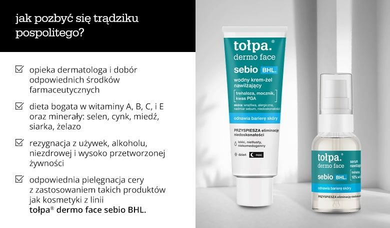 Jak pozbyć się trądziku pospolitego? - infografika.