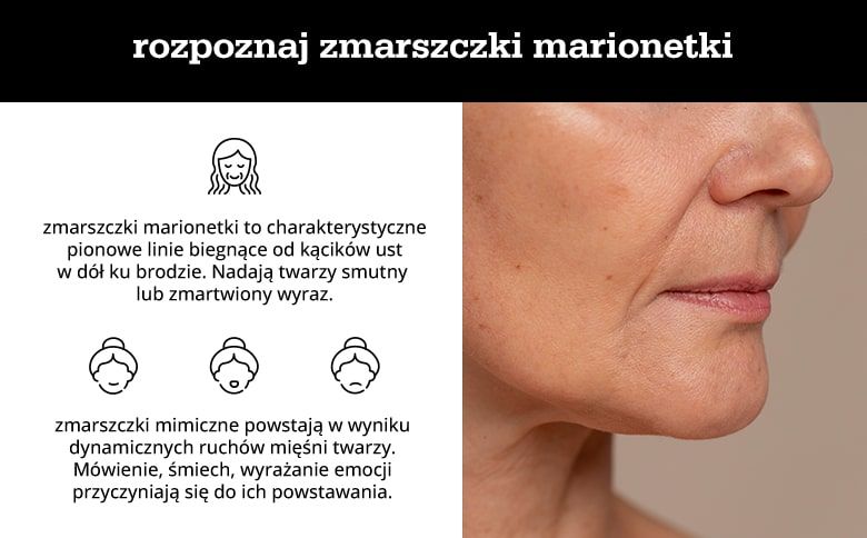  rozpoznaj zmarszczki marionetki - infografika